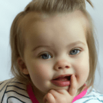 Ein süßes Baby mit Trisomie 21
